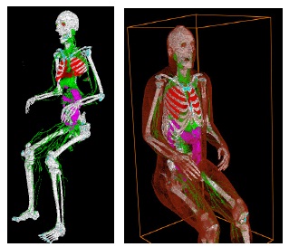 Dosimetry